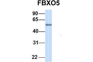 Host:  Rabbit  Target Name:  FBXO5  Sample Type:  Human Adult Placenta  Antibody Dilution:  1.