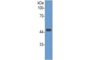 Mouse Capture antibody from the kit in WB with Positive Control: Human Spinal cord lysate.