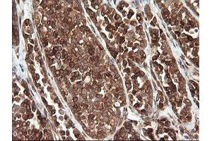 Image no. 8 for anti-TAP Binding Protein-Like (TAPBPL) antibody (ABIN1501300)