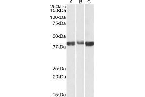 ABIN2613377 (0. (ALDOA anticorps  (AA 86-96))