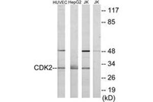 Western blot analysis of extracts from HuvEc/HepG2/Jurkat cells, using CDK2 Antibody. (CDK2 anticorps  (AA 231-280))