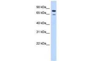 Image no. 1 for anti-Homolog of Yeast RecQ-mediated Genome Instability 1 (RMI1) (AA 71-120) antibody (ABIN6740966) (RMI1 anticorps  (AA 71-120))