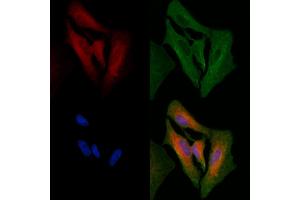 ABIN6264983 and ABIN6266656 staining  cells by IF/ICC. (SENP1 anticorps  (N-Term))