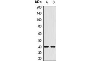 Western blot analysis of HMG-20A expression in HEK293T (A), Hela (B) whole cell lysates. (HMG20A anticorps)