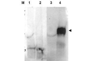 Image no. 1 for anti-Fibroblast Activation Protein, alpha (FAP) (Internal Region) antibody (ABIN401429) (FAP anticorps  (Internal Region))