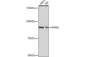 Western blot analysis of extracts of various cell lines, using PFKM Rabbit mAb (ABIN1678746, ABIN7101548, ABIN7101549 and ABIN7101550) at 1:1000 dilution. (PFKM anticorps)