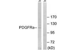 Western blot analysis of extracts from Jurkat cells, using PDGFRa (Ab-849) Antibody. (PDGFRA anticorps  (AA 816-865))