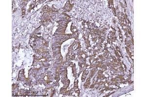 IHC analysis of ABP1/AOC1 using anti-ABP1/AOC1 antibody (ABIN7600040). (DAO anticorps  (AA 140-180))