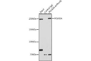 Immunoprecipitation analysis of 200 μg extracts of HeLa cells using 3 μg POLR2A antibody (ABIN3022932, ABIN3022933, ABIN3022934 and ABIN6219303).