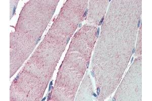 IHC testing of FFPE human skeletal muscle tissue with OSBPL1A antibody at 5ug/ml. (OSBPL1A anticorps)
