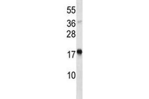 TSLP antibody western blot analysis in Jurkat lysate. (Thymic Stromal Lymphopoietin anticorps  (AA 101-130))