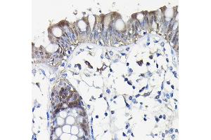 Immunohistochemistry of paraffin-embedded human colon using Galectin 3/Galectin 3/LG Rabbit pAb (ABIN7267338) at dilution of 1:100 (40x lens).