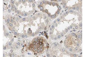 ABIN6272896 at 1/100 staining Mouse kidney tissue by IHC-P.