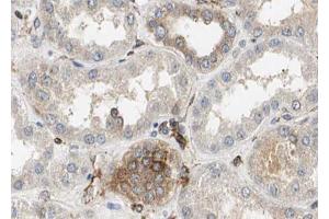 ABIN6272896 at 1/100 staining Mouse kidney tissue by IHC-P. (TIMM23 anticorps  (N-Term))