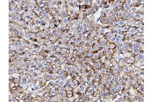 IHC analysis of EGFR using anti-EGFR antibody (ABIN7601478).