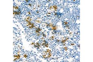 Immunohistochemistry of paraffin embedded rat bone using AHSP (ABIN7073016) at dilution of 1:300 (400x lens)