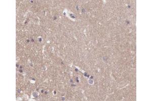 ABIN6266548 at 1/200 staining human brain tissue sections by IHC-P. (Metabotropic Glutamate Receptor 4 anticorps  (C-Term))