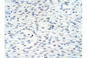 RNF8 antibody was used for immunohistochemistry at a concentration of 4-8 ug/ml to stain Myocardial cells (arrows) in Human Heart.