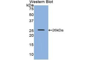 Detection of Recombinant PVRL2, Human using Polyclonal Antibody to Nectin 2 (NECTIN2) (PVRL2 anticorps  (AA 76-353))