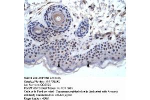 Human Skin (ZNF660 anticorps  (C-Term))