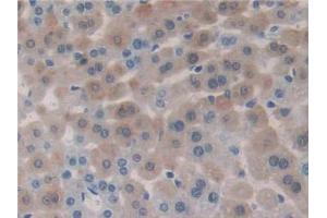 DAB staining on IHC-P; Samples: Mouse Liver Tissue