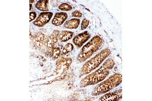 Anti-VCP antibody, IHC(F) IHC(F): Rat Intestine Tissue