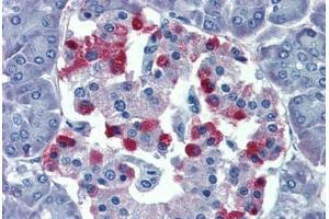 Pancreas, Human: Formalin-Fixed, Paraffin-Embedded (FFPE)