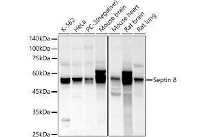 Western blot analysis of extracts of various cell lines, using Septin 8 antibody (ABIN7265350) at 1:1000 dilution. (Septin 8 anticorps  (AA 348-427))