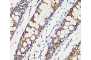 Immunohistochemistry of paraffin-embedded Human colon using TOM20 Polyclonal Antibody at dilution of 1:100 (40x lens). (TOMM20 anticorps)