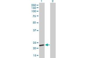 Western Blot analysis of BAG2 expression in transfected 293T cell line by BAG2 MaxPab polyclonal antibody. (BAG2 anticorps  (AA 1-211))