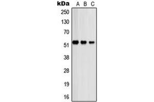 Western blot analysis of PSMD12 expression in A431 (A), COLO320 (B), HeLa (C) whole cell lysates. (PSMD12 anticorps  (Center))