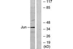 Western blot analysis of extracts from HeLa cells, using c-Jun (Ab-91) Antibody. (C-JUN anticorps  (AA 58-107))