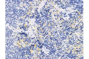 ABIN7094732 and ABIN7098783 at 1/100 staining Rat spleen tissue by IHC-P. (CD43 anticorps  (Internal Region))