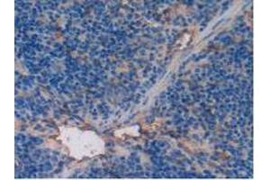 Detection of TM in Mouse Spleen Tissue using Polyclonal Antibody to Thrombomodulin (TM) (Thrombomodulin anticorps  (AA 31-167))