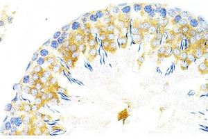 Immunohistochemistry of paraffin-embedded Rat testis using TAPBP Polyclonal Antibody at dilution of 1:200 (40x lens). (TAPBP anticorps)