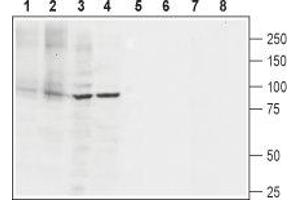 Western blot analysis of rat heart membranes (lanes 1 and 5), mouse heart membranes (lanes 2 and 6), rat PC12 pheochromocytoma cell line lysate (lanes 3 and 7) and human Jurkat T cell leukemia cell line lysate (lanes 4 and 8): - 1-4. (ATP2A2 anticorps  (2nd Cytoplasmic Loop))