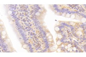 Detection of LEPR in Rat Small intestine Tissue using Polyclonal Antibody to Leptin Receptor (LEPR)