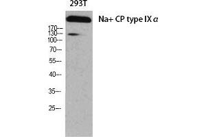 Western Blot analysis of various cells using Na+ CP type IXα Polyclonal Antibody diluted at 1:1000.