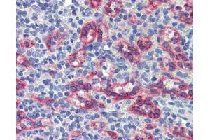 Anti-ZNF71 antibody IHC staining of human spleen. (ZNF71 anticorps  (Middle Region))