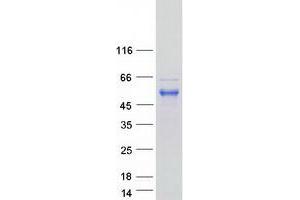 Validation with Western Blot