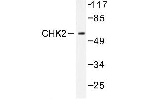 Image no. 1 for anti-Checkpoint Kinase 2 (CHEK2) (pSer379) antibody (ABIN272011) (CHEK2 anticorps  (pSer379))