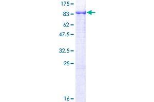 Image no. 1 for Glyceronephosphate O-Acyltransferase (GNPAT) (AA 1-680) protein (GST tag) (ABIN1355427)