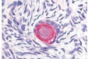 Immunohistochemistry (IHC) image for anti-delta-Like 4 (DLL4) antibody (ABIN2473319)
