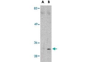 Western blot analysis of MARCH8 in HeLa cell lysate with MARCH8 polyclonal antibody  at (A) 0. (MARCH8 anticorps  (C-Term))