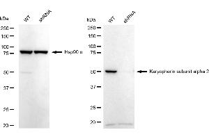 Western blotting analysis using karyopherin subunit alpha 2 antibody (ABIN7800945).
