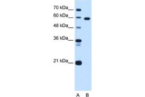 Western Blotting (WB) image for anti-T-Box 15 (TBX15) antibody (ABIN2463095) (T-Box 15 anticorps)