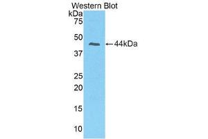 Western Blotting (WB) image for anti-Prolactin-Induced Protein (PIP) (AA 1-146) antibody (ABIN1860229) (PIP anticorps  (AA 1-146))