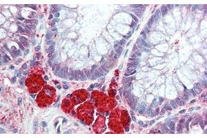 Detection of HEXb in Human Colon Tissue using Polyclonal Antibody to Hexosaminidase B Beta (HEXb) (HEXB anticorps  (AA 122-311))