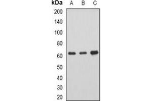 Western blot analysis of AHCYL1 expression in SKOV3 (A), mouse brain (B), rat spinal cord (C) whole cell lysates. (AHCYL1 anticorps)