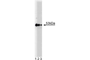 Western Blotting (WB) image for anti-Protein Kinase, CAMP-Dependent, Regulatory, Type II, beta (PRKAR2B) (AA 1-418) antibody (ABIN968073) (PRKAR2B anticorps  (AA 1-418))